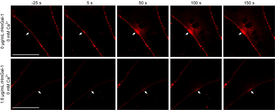 galectin-1_article_4_photo